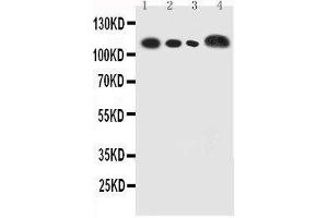Anti-human CEACAM5 antibody, Western blotting Lane 1: Recombinant Human CEA Protein 5ng Lane 2: Recombinant Human CEA Protein 2 (CEACAM5 anticorps  (full length))