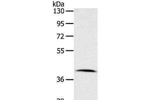 Western Blot analysis of Human lymphoma tissue using CDK10 Polyclonal Antibody at dilution of 1:100 (CDK10 anticorps)