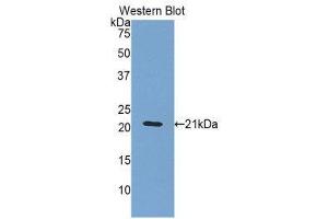 Western Blotting (WB) image for anti-Orosomucoid 1 (ORM1) (AA 20-186) antibody (ABIN3207789) (ORM1 anticorps  (AA 20-186))