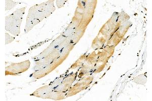 ABIN6263464 and ABIN6278377 at 1/100 staining Rat skin tissue by IHC-P. (MYH2 anticorps  (Internal Region))