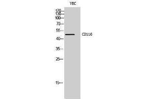 Western Blotting (WB) image for anti-Colony Stimulating Factor 2 Receptor, Alpha, Low-Affinity (Granulocyte-Macrophage) (CSF2RA) (Internal Region) antibody (ABIN3183730)