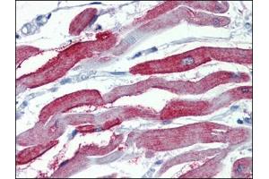 Immunohistochemistry Image: Human Heart: Formalin-Fixed, Paraffin-Embedded (FFPE) (Junctophilin 2 anticorps  (C-Term))