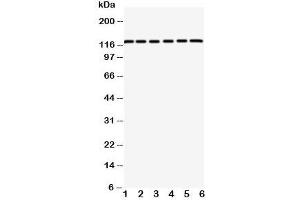 Western blot testing of CAR antibody and rat samples 1: pancreas;  2: brain;  3: heart; and human samples 4: HeLa;  5: 293T;  6: COLO320 cell lysate. (Coxsackie Adenovirus Receptor anticorps  (C-Term))
