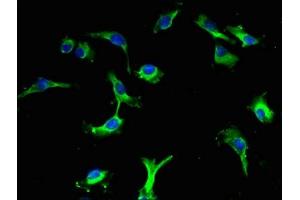 Immunofluorescent analysis of U251 cells using ABIN7158439 at dilution of 1:100 and Alexa Fluor 488-congugated AffiniPure Goat Anti-Rabbit IgG(H+L)