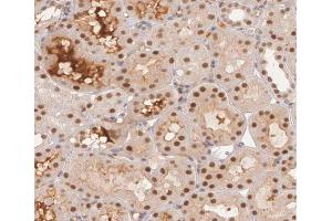 ABIN6267376 at 1/200 staining human kidney tissue sections by IHC-P.