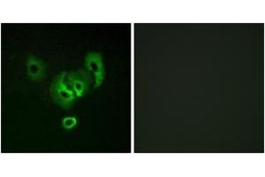 Immunofluorescence analysis of A549 cells, using STEA2 Antibody.