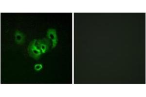 Immunofluorescence analysis of A549 cells, using STEA2 Antibody. (STEAP2 anticorps  (AA 431-480))