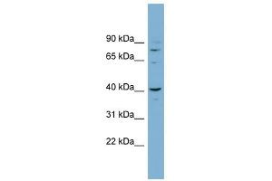 CASC3 antibody used at 1 ug/ml to detect target protein. (CASC3 anticorps  (N-Term))