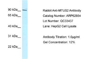 Western Blotting (WB) image for anti-Microtubule-associated Tumor Suppressor Candidate 2 (MTUS2) (C-Term) antibody (ABIN2789269)