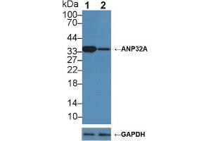 Knockout Varification: Lane 1: Wild-type Hela cell lysate, Lane 2: ANP32A knockout Hela cell lysate, Predicted MW: 29kd Observed MW: 35kd Primary Ab: 1 μg/mL Rabbit Anti-Human ANP32A Antibody Second Ab: 0.