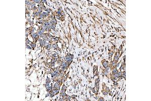 IHC analysis of SUCLG2 using anti-SUCLG2 antibody (ABIN7601694). (SUCLG2 anticorps  (AA 42-424))