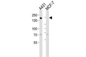 Western blot analysis of lysate from A431, MCF-7 cell line (left to right) using EGF Receptor antibody at 1:1000 for each lane.