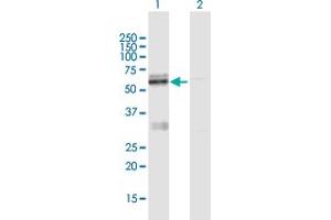 Western Blot analysis of LMF1 expression in transfected 293T cell line by LMF1 MaxPab polyclonal antibody. (LMF1 anticorps  (AA 1-567))