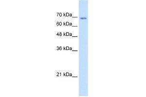 WB Suggested Anti-TM9SF1 Antibody Titration:  1. (TM9SF1 anticorps  (N-Term))