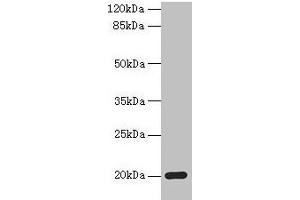 Western blot All lanes: MPV17 antibody at 2 μg/mL + Mouse heart tissue Secondary Goat polyclonal to rabbit IgG at 1/10000 dilution Predicted band size: 20 kDa Observed band size: 20 kDa (MPV17 anticorps  (AA 1-176))