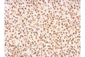 IHC-P Image Rad9 antibody detects RAD9A protein at nucleus on HBL435 xenograft by immunohistochemical analysis.
