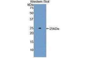 Western Blotting (WB) image for anti-Androgen Receptor (AR) (AA 491-679) antibody (ABIN1174429) (Androgen Receptor anticorps  (AA 491-679))