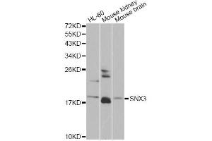 Western blot analysis of extracts of various cell lines, using SNX3 antibody.