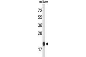 Western blot analysis of Glutathione peroxidase 1 / GPX1 (arrow) in mouse liver tissue lysates (35ug/lane) using Glutathione peroxidase 1 / GPX1  Antibody (C-term). (Glutathione Peroxidase 1 anticorps  (C-Term))