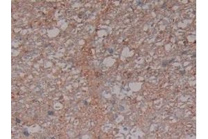 Detection of SNCG in Rat Spinal cord Tissue using Polyclonal Antibody to Gamma-synuclein (SNCG)