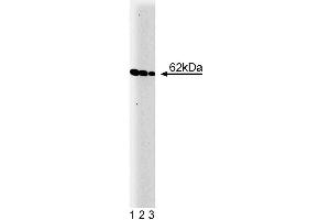 Western blot analysis of Yes on a A431 cell lysate (Human epithelial carcinoma, ATCC CRL-1555). (YES1 anticorps  (AA 10-193))