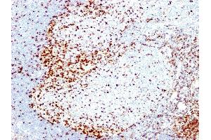 Formalin-fixed, paraffin-embedded human Tonsil stained with ZAP70 Mouse Monoclonal Antibody (2F3. (ZAP70 anticorps  (AA 1-254))