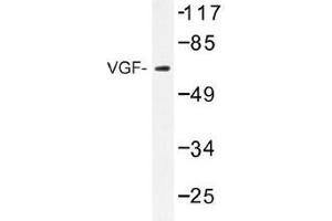 Image no. 1 for anti-VGF Nerve Growth Factor Inducible (VGF) antibody (ABIN317924) (VGF anticorps)