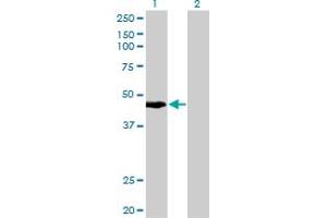 Western Blot analysis of KRTHA4 expression in transfected 293T cell line by KRTHA4 monoclonal antibody (M10), clone 3E5. (Keratin 34 anticorps  (AA 337-436))
