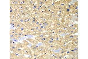 Immunohistochemistry of paraffin-embedded Mouse heart using RPH3A Polyclonal Antibody at dilution of 1:100 (40x lens). (RPH3A anticorps)