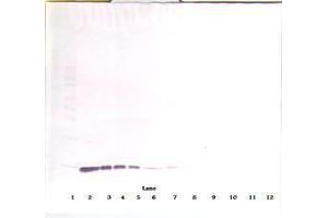 Image no. 1 for anti-Interleukin 2 (IL2) antibody (ABIN465098) (IL-2 anticorps)