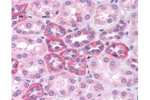 Immunohistochemistry (IHC) image for anti-SRY (Sex Determining Region Y)-Box 2 (SOX2) (N-Term) antibody (ABIN2777428)