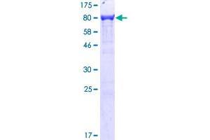 Image no. 1 for Plastin 3 (PLS3) (AA 1-630) protein (GST tag) (ABIN1315467)