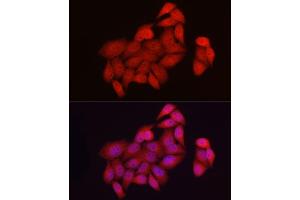 Immunofluorescence analysis of HeLa cells using NUR77 Rabbit pAb (ABIN6134860, ABIN6144825, ABIN6144828 and ABIN6217265) at dilution of 1:50 (40x lens). (NR4A1 anticorps)