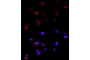 Immunofluorescence analysis of HeLa cells using KMT2A antibody  at dilution of 1:100 (40x lens).
