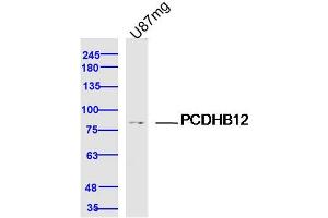 U87MG lysates probed with PCDHB12 Polyclonal Antibody, Unconjugated  at 1:300 dilution and 4˚C overnight incubation. (PCDHB12 anticorps  (AA 121-220))