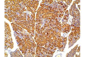 ABIN6256775 and ABIN6267452 at 1/100 staining mouse pancreatic tissue sections by IHC-P. (PIK3R1 anticorps  (pTyr607))