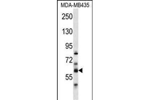 PTDSS2 Antibody (N-term) (ABIN656975 and ABIN2846159) western blot analysis in MDA-M cell line lysates (35 μg/lane). (PTDSS2 anticorps  (N-Term))