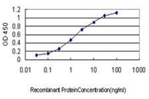 Detection limit for recombinant GST tagged RRM2 is approximately 0.