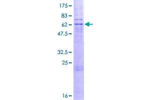 Image no. 1 for Presenilin Associated, Rhomboid-Like (PARL) (AA 1-379) protein (GST tag) (ABIN1314016)