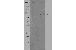 Western blot analysis of extracts from Jurkat cells, using NOX5 antibody. (NOX5 anticorps  (C-Term))