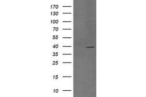 Image no. 3 for anti-Mitogen-Activated Protein Kinase Kinase 3 (MAP2K3) antibody (ABIN1499403)