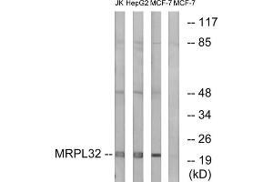 Western blot analysis of extracts from Jurkat cells, MCF-7 cells and HepG2 cells, using MRPL32 antibody.