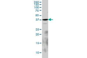 EPM2A monoclonal antibody (M02), clone 6C6 Western Blot analysis of EPM2A expression in PC-12 . (EPM2A anticorps  (AA 101-199))