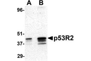 Western Blotting (WB) image for anti-Ribonucleotide Reductase M2 B (TP53 Inducible) (RRM2B) (N-Term) antibody (ABIN1031501) (RRM2B anticorps  (N-Term))