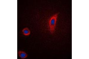 Immunofluorescent analysis of PGHS-2 staining in Jurkat cells. (PTGS2 anticorps  (C-Term))