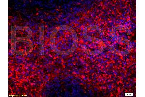 Formalin-fixed and paraffin embedded rat spleen tissue labeled with Anti-SCF Polyclonal Antibody (ABIN669936) , Unconjugated at 1:200, followed by conjugation to the secondary antibody Goat Anti-Rabbit IgG, PE conjugated used at 1:200 dilution for 40 minutes at 37 °C.