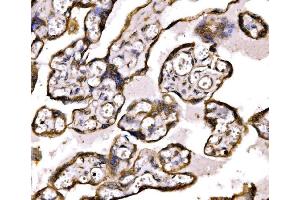 IHC analysis of BRSK1 using anti-BRSK1 antibody (ABIN7600990).