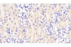 Detection of SDHA in Mouse Kidney Tissue using Polyclonal Antibody to Succinate Dehydrogenase Complex Subunit A (SDHA)