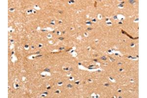 The image on the left is immunohistochemistry of paraffin-embedded Human brain tissue using ABIN7190258(CHRNA3 Antibody) at dilution 1/30, on the right is treated with synthetic peptide. (CHRNA3 anticorps)