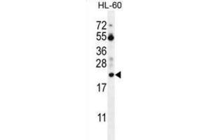 Western Blotting (WB) image for anti-Prothymosin, alpha (PTMA) antibody (ABIN2996364) (PTMA anticorps)